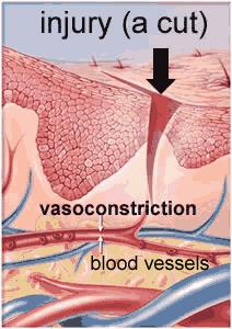Inflammatory process 1. stimulus (cut) 2. Initial local vasoconstriction( blood loss) 3.
