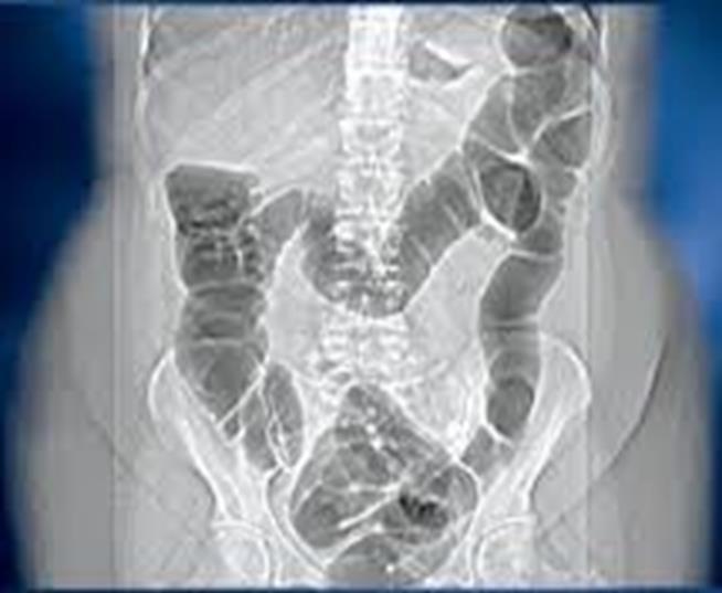 CT Colon Service & Radiology Pathways Louisa Edwards CT Colon Advanced Radiography Practitioner