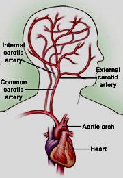 3. Carotid Arteries