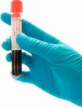 The aim of a blood transfusion laboratory in testing blood samples from patients and donors is