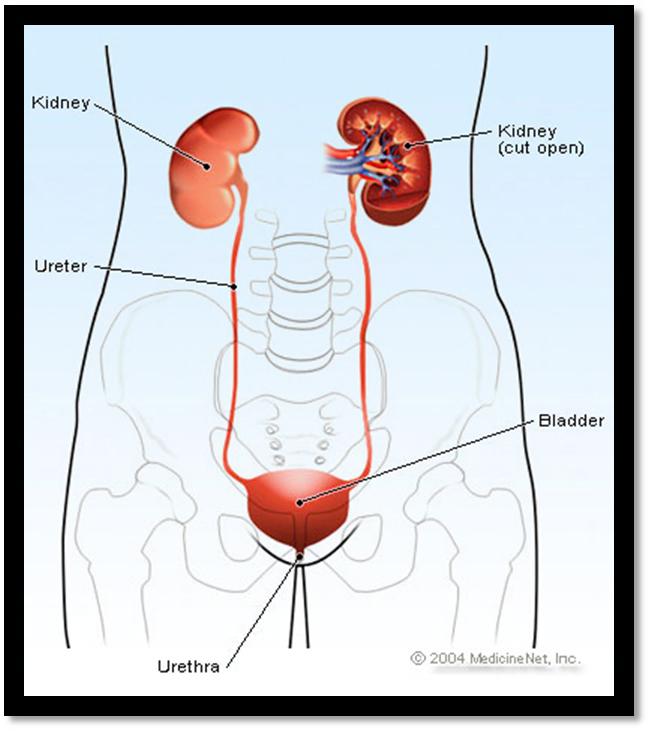 What is hydronephrosis? Hydronephrosis Hydronephrosis describes the situation where the urine collecting system of the kidney is dilated.