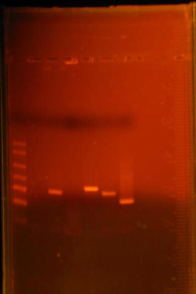 III. Results Each lab group took pictures of individual plasmids after undergoing gel electrophoresis. This picture shows our plasmid sample from Farm B, or Calli s Cows and Bulls.
