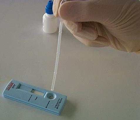 Uni-Gold Recombigen HIV Assay Procedure Holding the pipette vertically over the sample port, add one (1) drop of