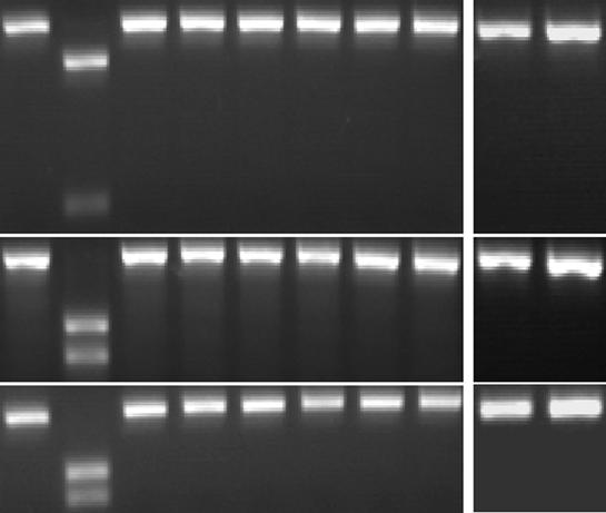 Yang et al. Genome Biology (215) 16:52 Page 9 of 17 Frequency 25% 2% 15% 1% 5% % X -2-1.6-1.2 -.8 -.4.4.8 1.2 1.6 2 Bin (log 2 fold change) B SNP-read counts Firre si&shrn 2 16 12 8 4 R 2 =.