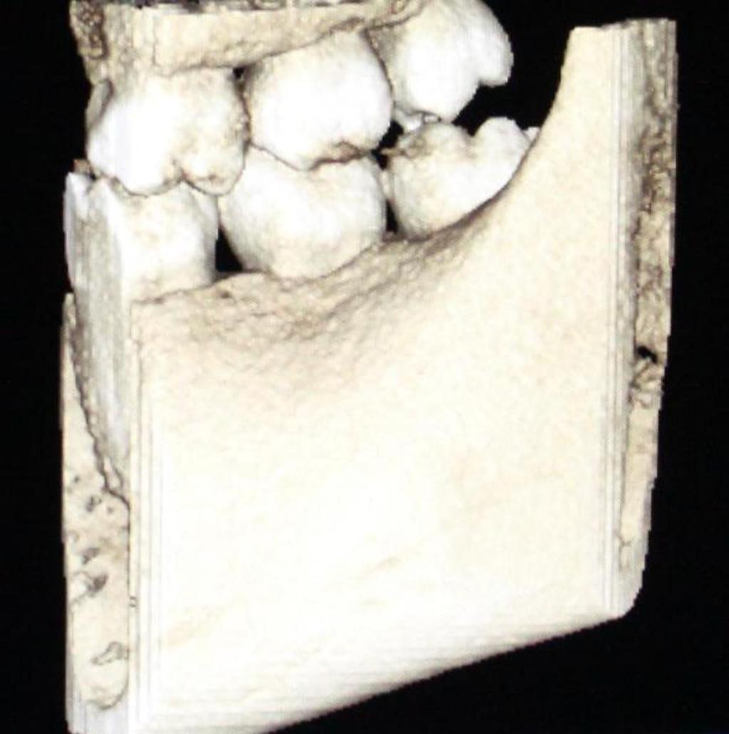 Fig. 3: A 3D reconstruction of images taken with