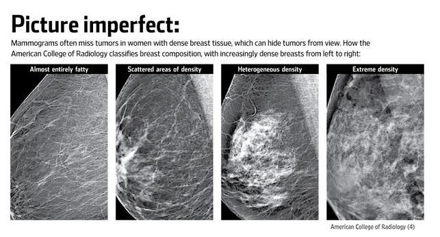 Examples in Europe Tailored ~ RCT offering MRI to women with ACR