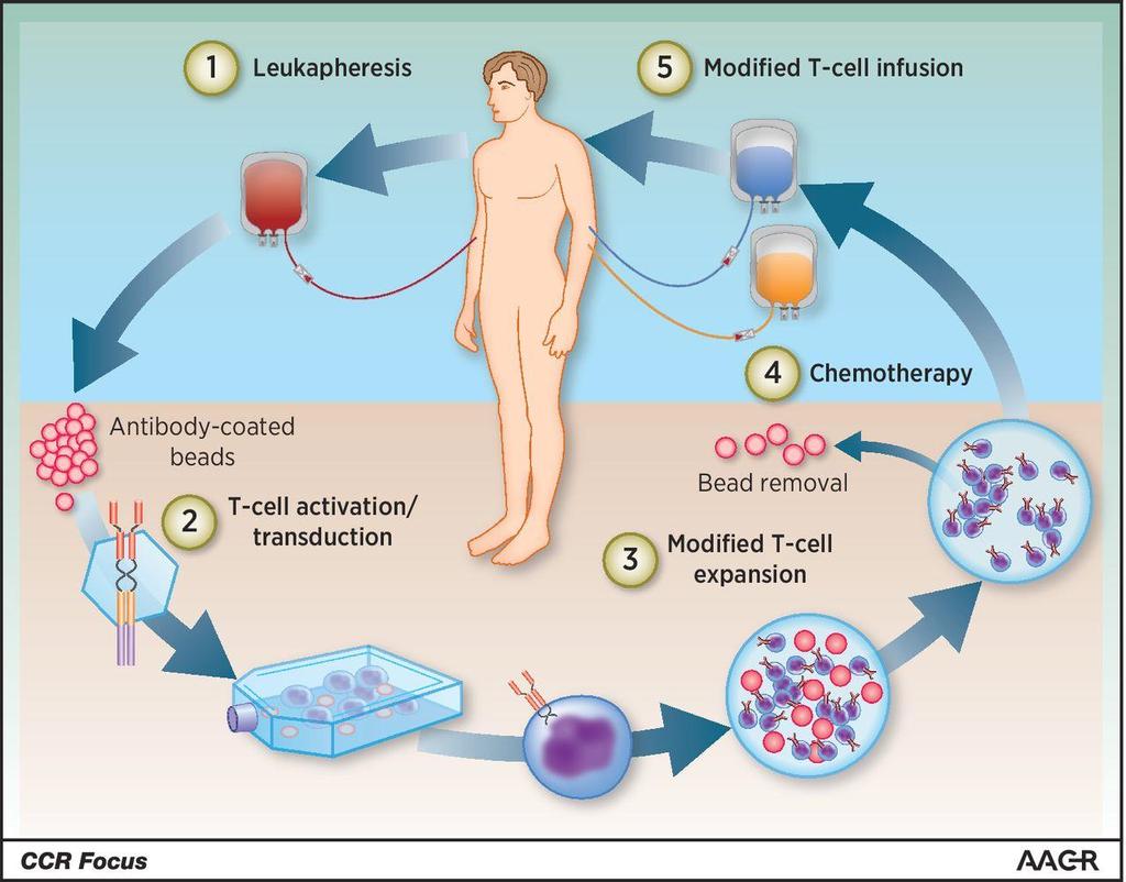 ANOTHER STRATEGY: MAKE THE T-CELLS RECOGNIZE THE TUMOUR OVERVIEW OF CAR T-CELL THERAPY IN