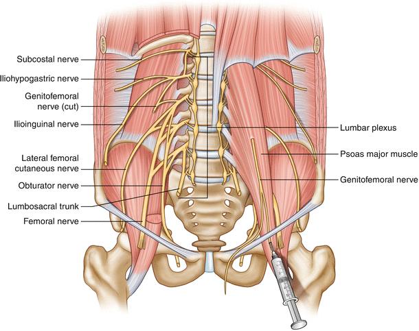 Lumbar Plexus Nerves relation to psoas