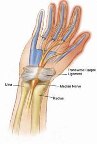 Symptoms/Signs- Neuropathy Peripheral neuropathy Ascending numbness Muscle weakness Gait Muscle atrophy Autonomic neuropathy