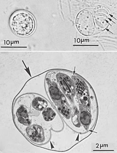 3124 Part III Infectious Diseases and Their Etiologic Agents A B C D FIGURE 280-1 The three forms of Toxoplasma gondii observed in nature. A, Oocysts. Unsporulated oocyst (top left).