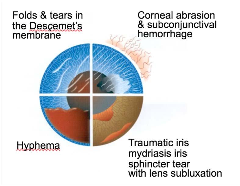 Eye Infections and Injuries Nontraumatic Subconjunctival Hemorrhage Conjunctivitis Keratitis Microbial Keratitis Marginal Keratitis Uveitis Periorbital Ecchymosis Orbital Cellulitis