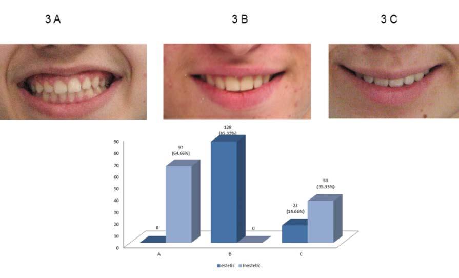 SMILE APPRECIATED BY LAYPERSONS Figure 9 The aesthetic and unaesthetic percentage for each variant of the component 3, Figure 10 The aesthetic and unaesthetic percentage for each variant of the