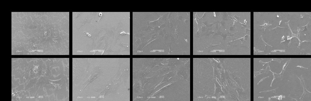 Figure S1. SEM images of racs upon coculture with rmscs. racs were cocultured with different densities of rmscs for 48 h and then fixed for SEM observation at 500 and 1000 magnifications.