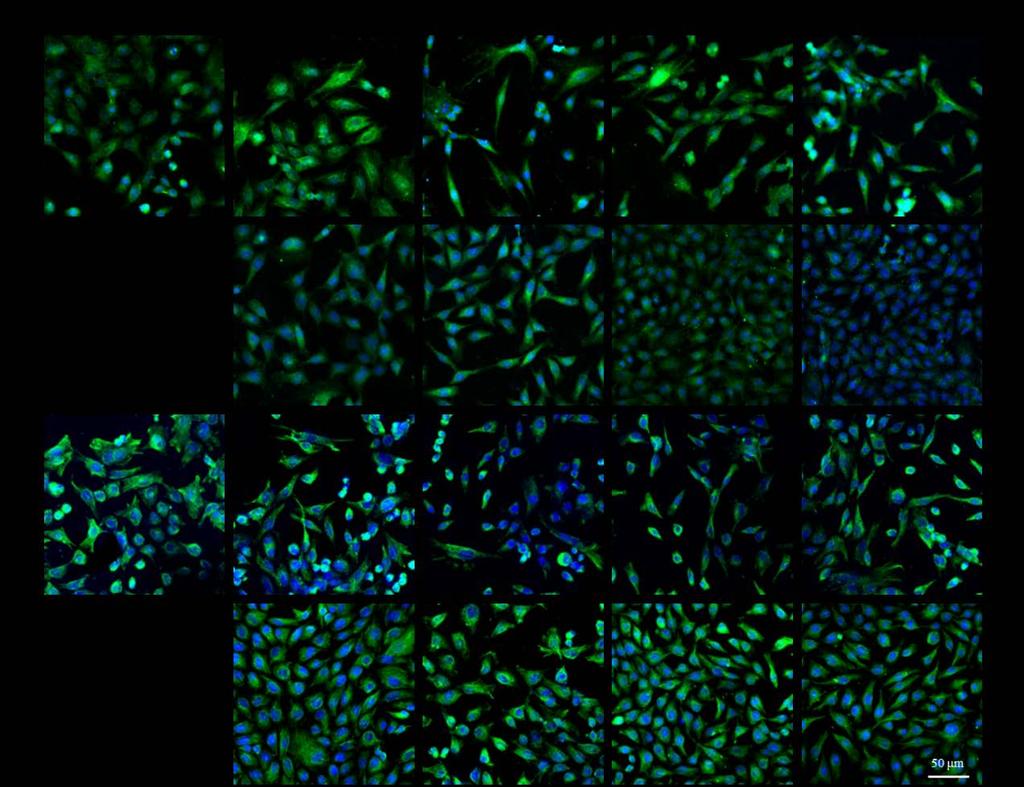 Figure S2. Immunofluorescence staining of α-tubulin and vimentin for racs in coculture.
