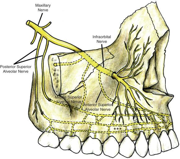 Development of the Maxilla The maxilla develops by intramembranous ossification within the maxillary