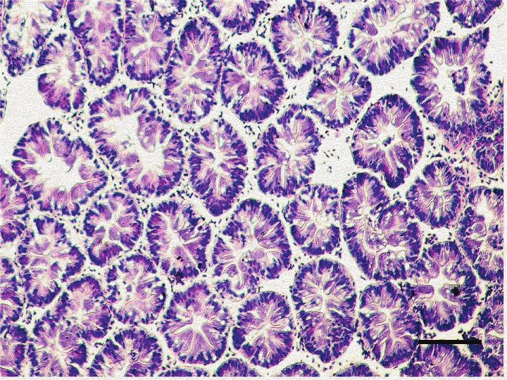 Hepatopancreatic tissue of the adult M. nipponense exposed to 1.