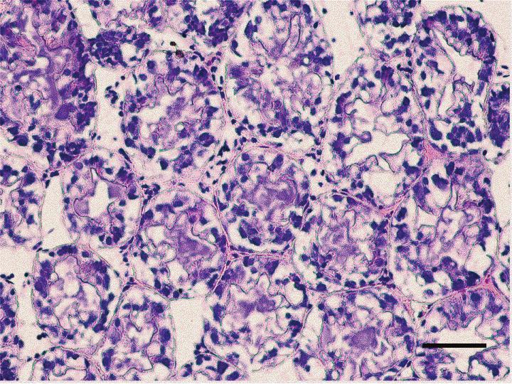 46 J. L. YANG ET AL. Figure 3. Hepatopancreatic tissue of adult M. nipponense exposed to 4.0 mgsb/l for 14 d.