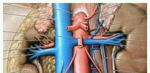 Renal Vein Entrapment Syndrome (Nutcracker syndrome) Compression of left renal vein between the SMA anteriorly and the abdominal aorta