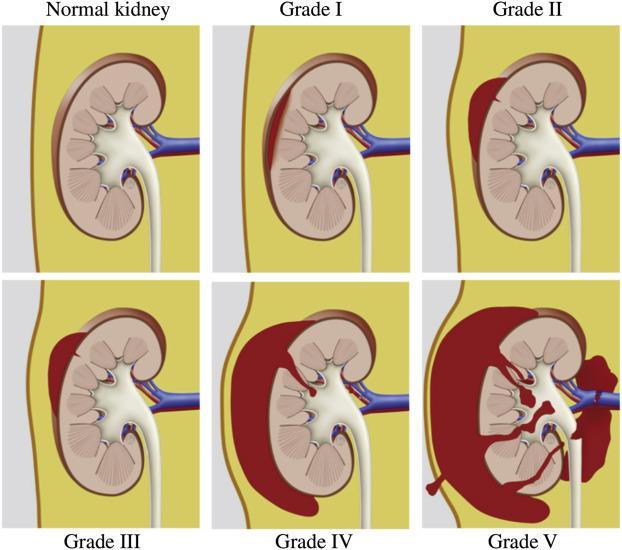 Kidney Trauma The kidneys are well protected by the lower ribs, the lumbar muscles, and the vertebral column.