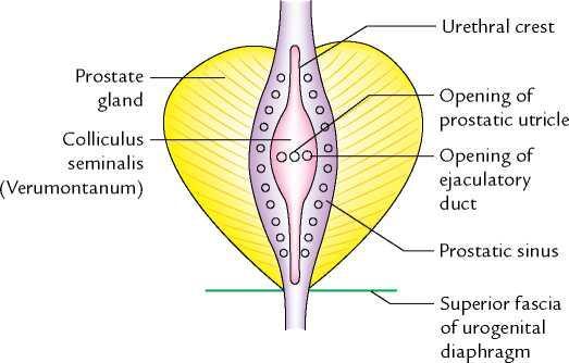 Special features of prostatic part of urethra Urethral crest: is a median longitudinal elevation in the mucous membrane
