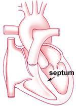 Structures of the Heart Septum Separates the left and right sides of the heart Prevents the