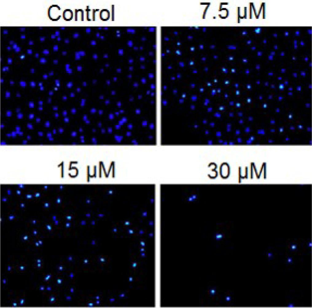 The results of the DAPI staining showed that the number of cells with white color nuclei increased, indicative of the apoptosis (Figure 3).