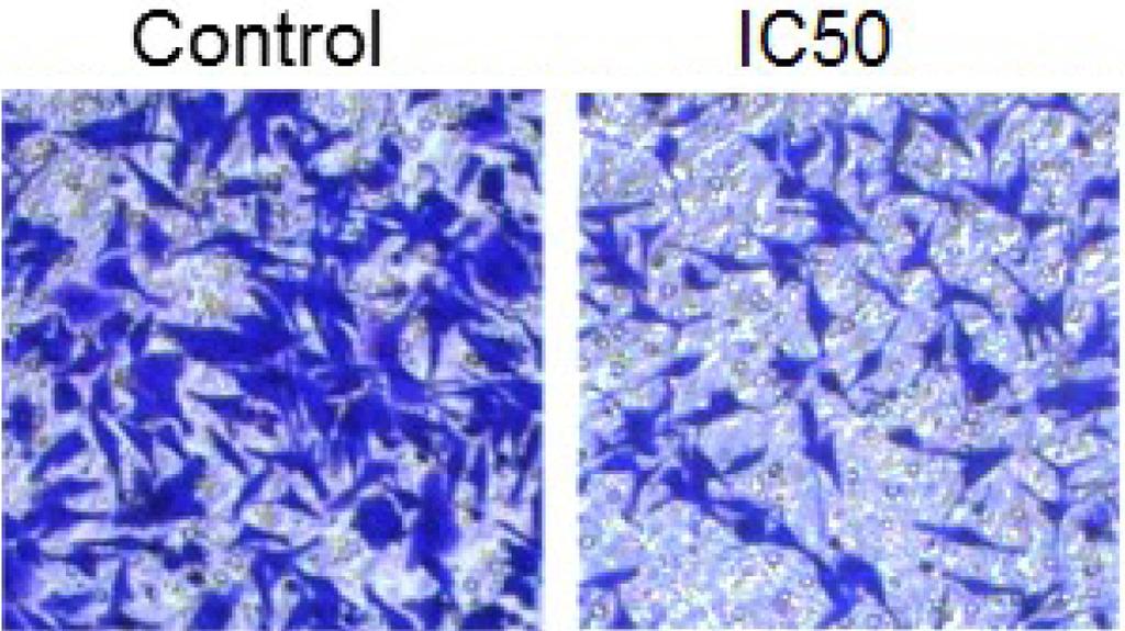 Linderalactone exerts anticancer activity in lung cancer 569 creased, while Bcl-2 decreased in a concentrationdependent manner (Figure 5).