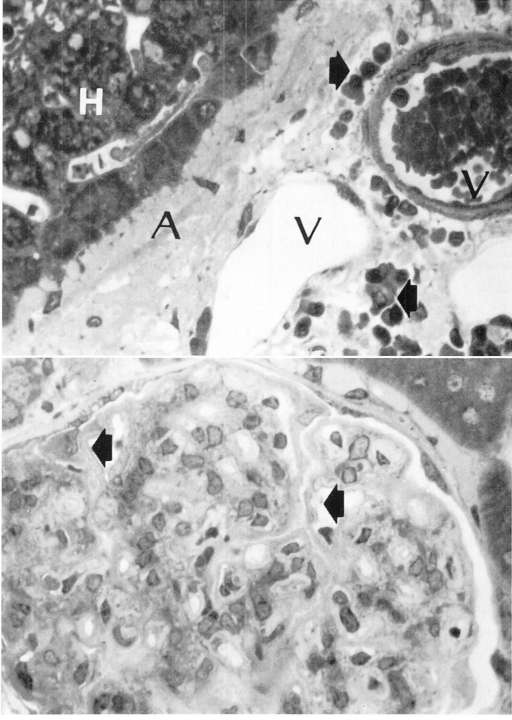 I82 CROWELL/VOTAVA Fig. 1. A section, I pm thick, of liver of hamster with amyloidosis. There are large amounts of amyloid (A) adjacent t o the hepatocytes (H) and vessels (V).