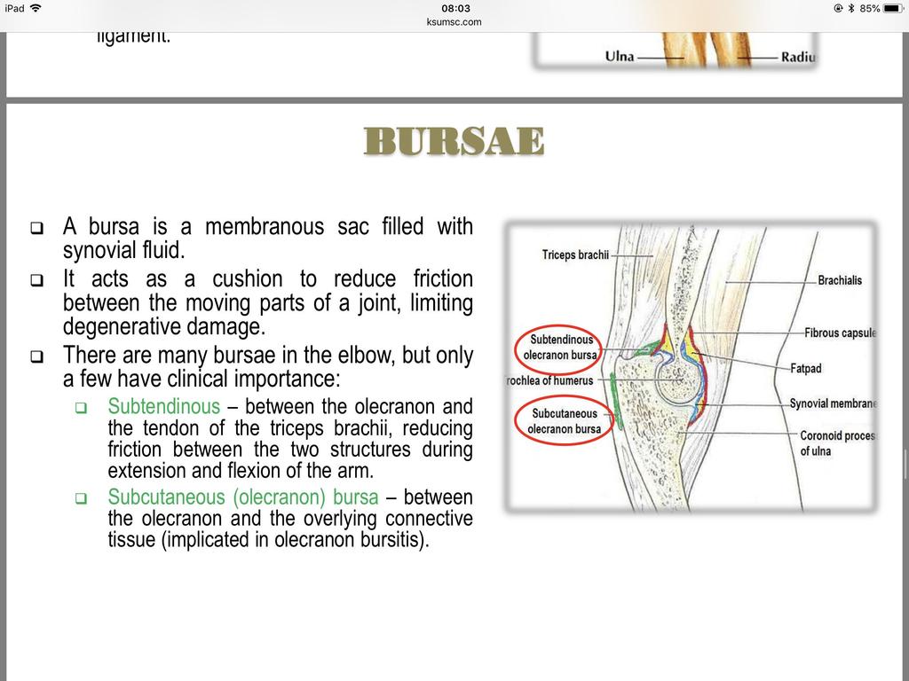 BURSA: Only found in boys slide A bursa is a membranous sac filled with synovial fluid. It acts as a cushion to reduce friction between the moving parts of a joint, limiting degenerative damage.