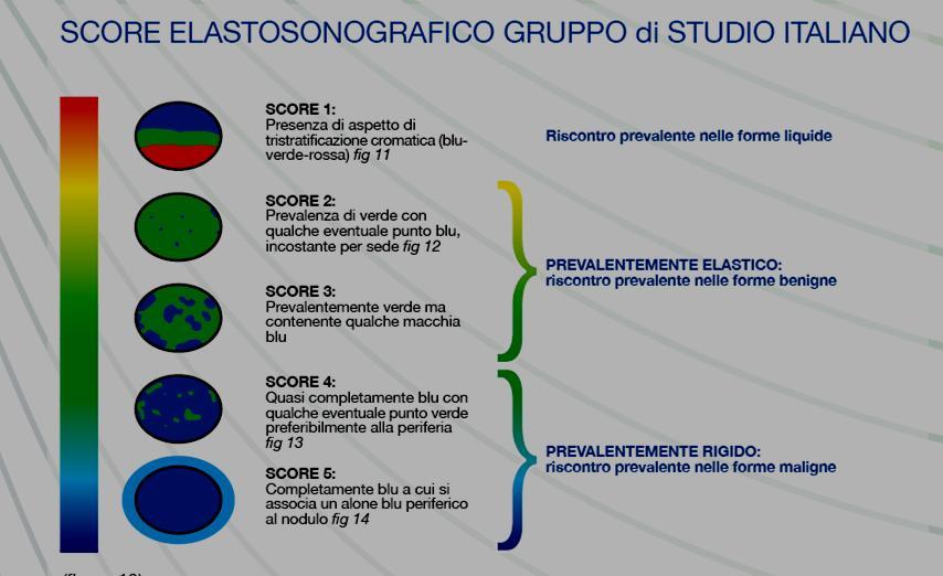 MALIGNANT BENIGN The Italian Team of Study, on the basis of its clinical experience of above 1000 cases studied, proposes a revision of the classification of Prof. Ueno.