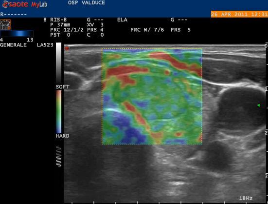 What can be studied with Elastosonography?
