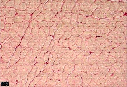 histological sections stained with picro-sirius