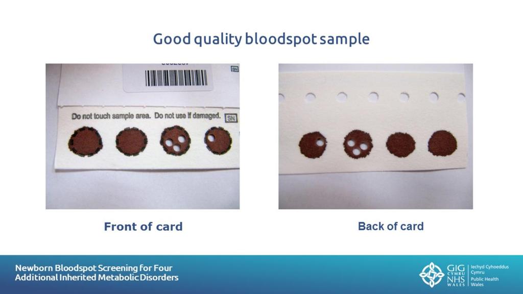 Slide 23: Good quality bloodspot sample This photograph shows an example of a good quality bloodspot sample as seen from the front and the