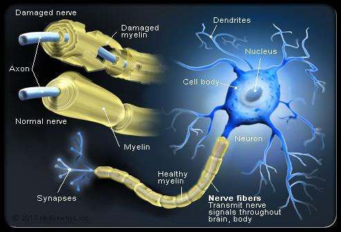 axons travelling together MS and myelin Inflammation leads to