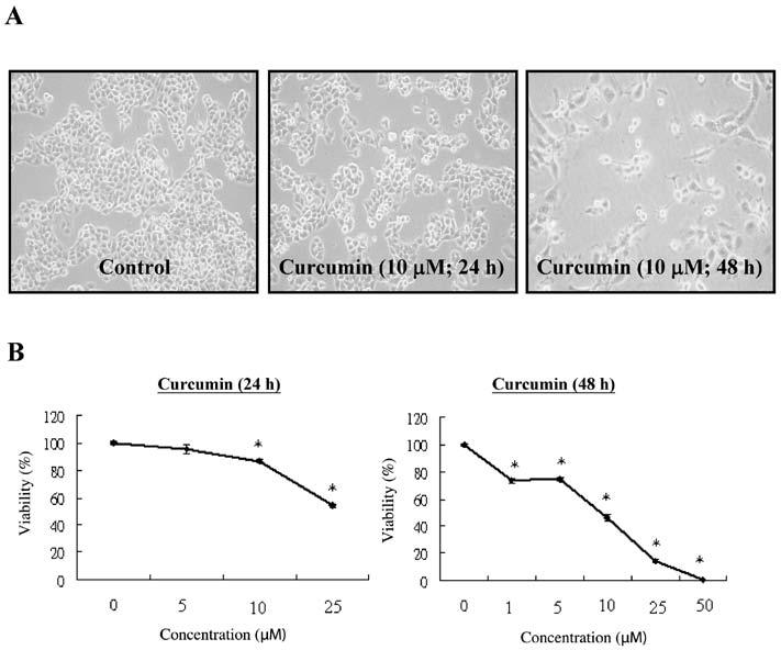 INTERNATIONAL JOURNAL OF ONCOLOGY 39: 319-328, 2011 321 Figure 1. Curcumin induced cell morphological changes and decreased the percentage of viable NPC-TW 076 cells.