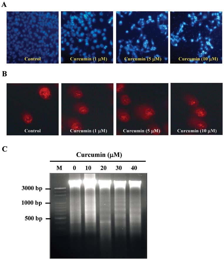 INTERNATIONAL JOURNAL OF ONCOLOGY 39: 319-328, 2011 323 Figure 3. Curcumin induced apoptosis and DNA damage in NPC-TW 076 cells. Cells were treated with various concentrations of curcumin for 24 h.