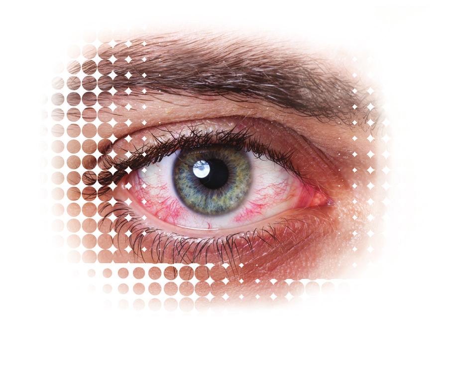 DRY EYE HAS MANY CAUSES Here are a few: Aging. Systemic disease. Topical or systemic medications. History of eye surgery. Environmental factors (poor ventilation, poor air quality).