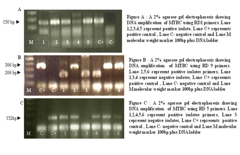 Figure 2: A 2% agarose gel electrophoresis showing DNA amplification of