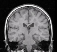 Brain Parcellation and Lesion Segmentation T1-weighted structural scan