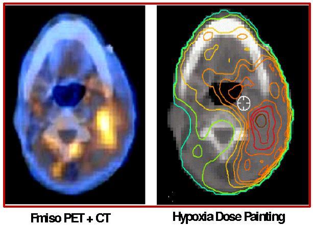 Tomotherapy-IMRT as an option for patients with hypoxic tumors identified by PET/MRI? If PET or MRI imaging can reliably define hypoxic zones in tumors, then what are the possibilities?