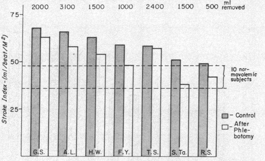 In the six subjects studied two to, eight weeks postphlebotomy (excluding the one instance when measurements were made immediately after bleeding), the average hematocrit was reduced from.62 to.45.
