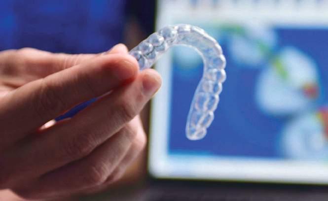 Using the advanced capabilities of the software and clinical expertise of the SureSmile Tech Center, each aligner is custom designed to the clinician s treatment plan, and anatomically designed to