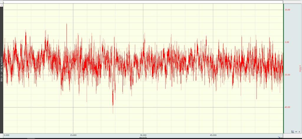 Figure 7: EEG negative control data.