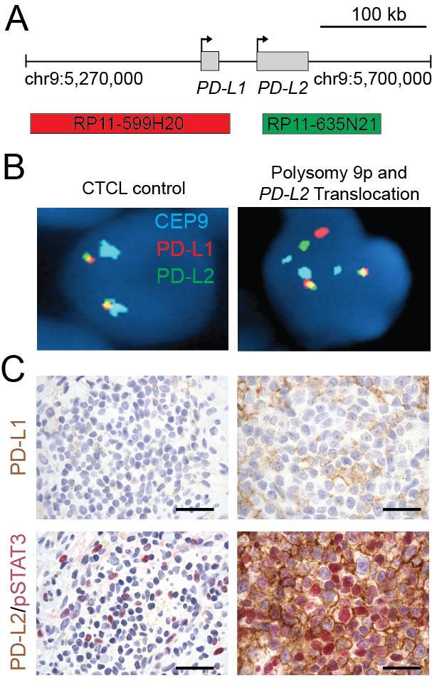PD-L2 Translocation in a Cutaneous T-cell Lymphoma Patient with the translocation had a partial response