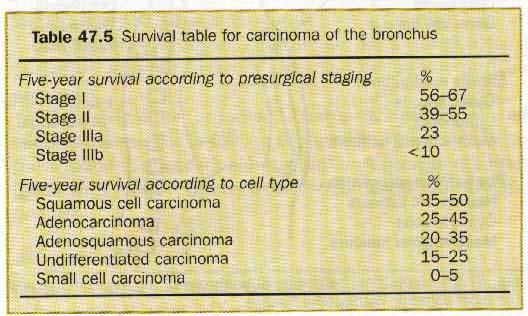 Survival The 5-year survival rate is less than 2% if no treatment is offered at the time of diagnosis and ipsilateral
