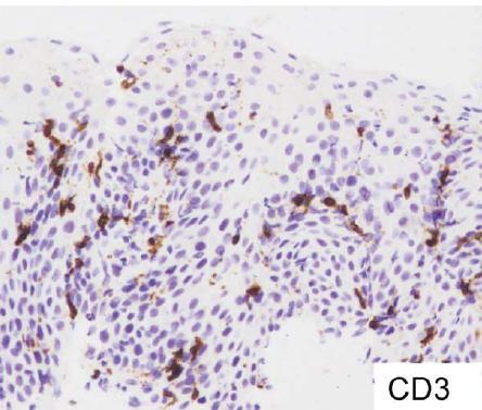 T Cells Increased CD3+ Increased