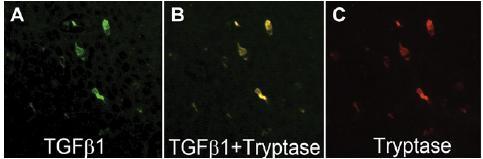 Mast Cells and TGFb1