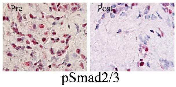 psmad2/3 Cells TGFb