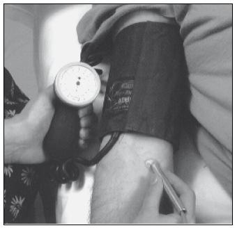 MEASUREMENT OF THE BRACHIAL SYSTOLIC PRESSURE Step 1: Wrap the cuff firmly around the upper arm, as high as possible, with the bladder of the cuff over the brachial artery (ie over the antecubital