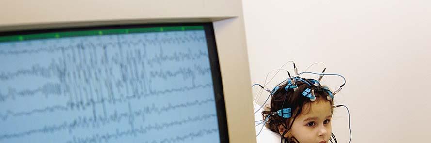 Electroencephalogram (EEG) An amplified